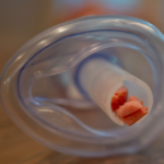 “Because of this device my son is alive! Thank god!”